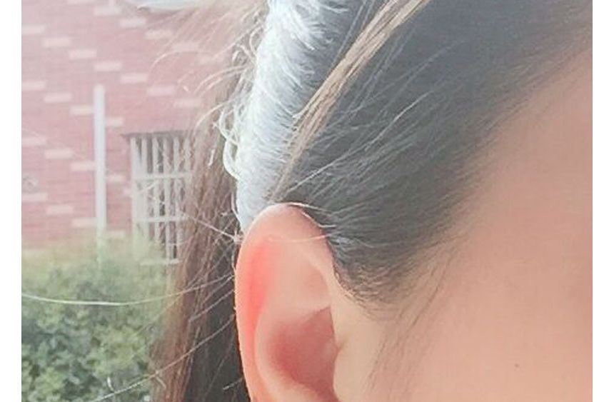Button Ear Stud